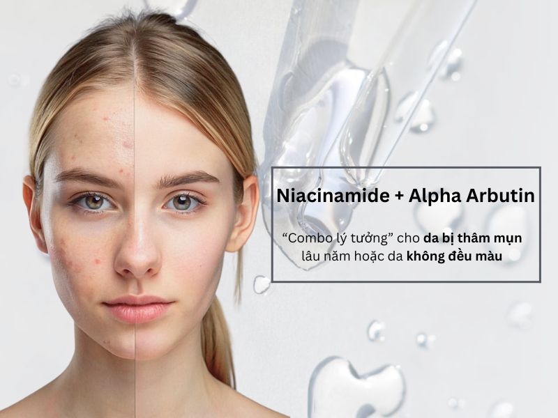 Niacinamide + Alpha Arbutin - Làm đều màu da, trị thâm mụn