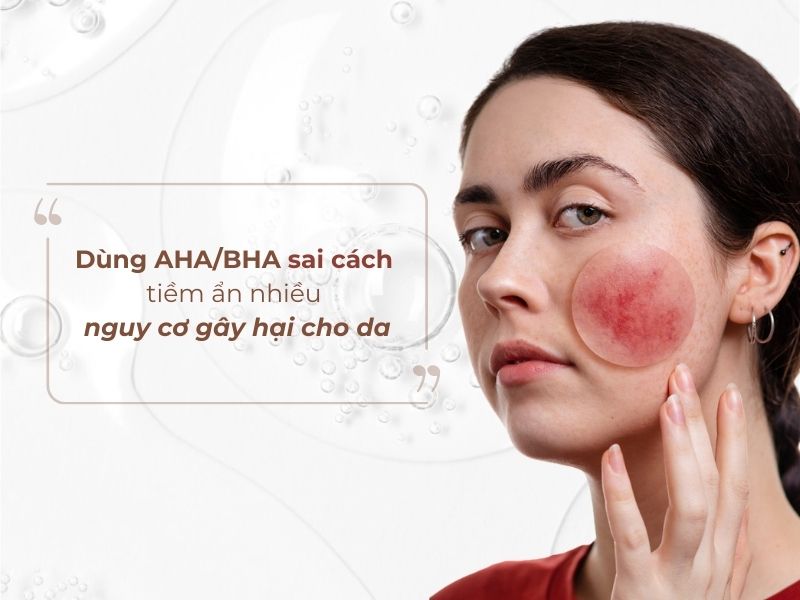 Dùng aha/bha sai cách tiềm ẩn nhiều nguy cơ gây hại cho da